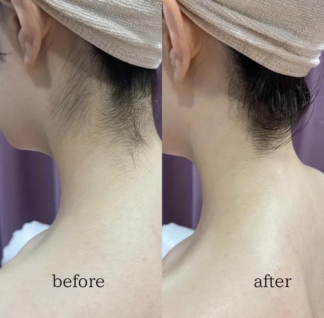 ボディーシェービング