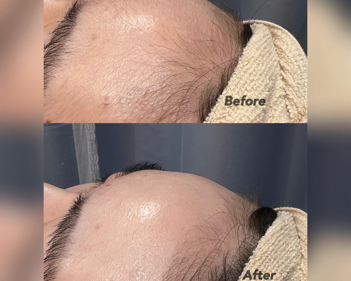 顔+うなじ＋拭き取りパック