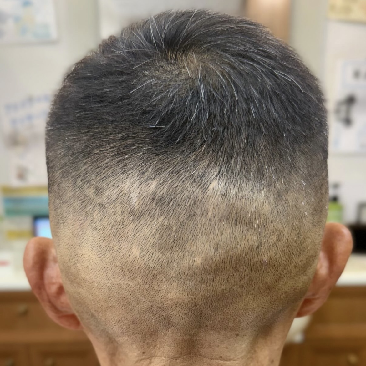 総合調髪+スキンフェード